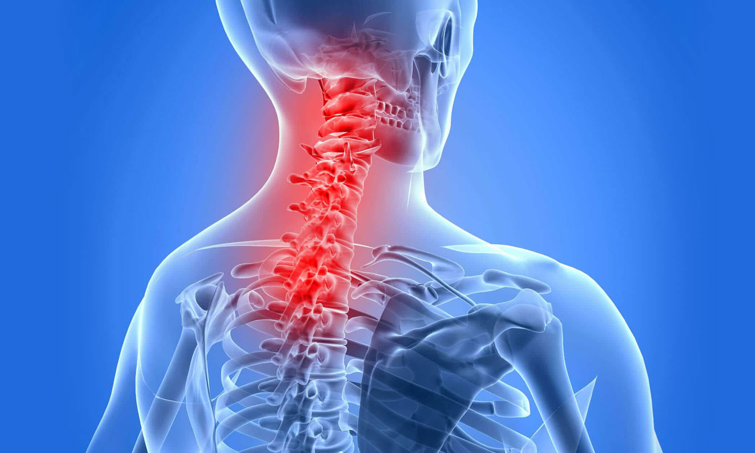 Ankylosing Spondylitis