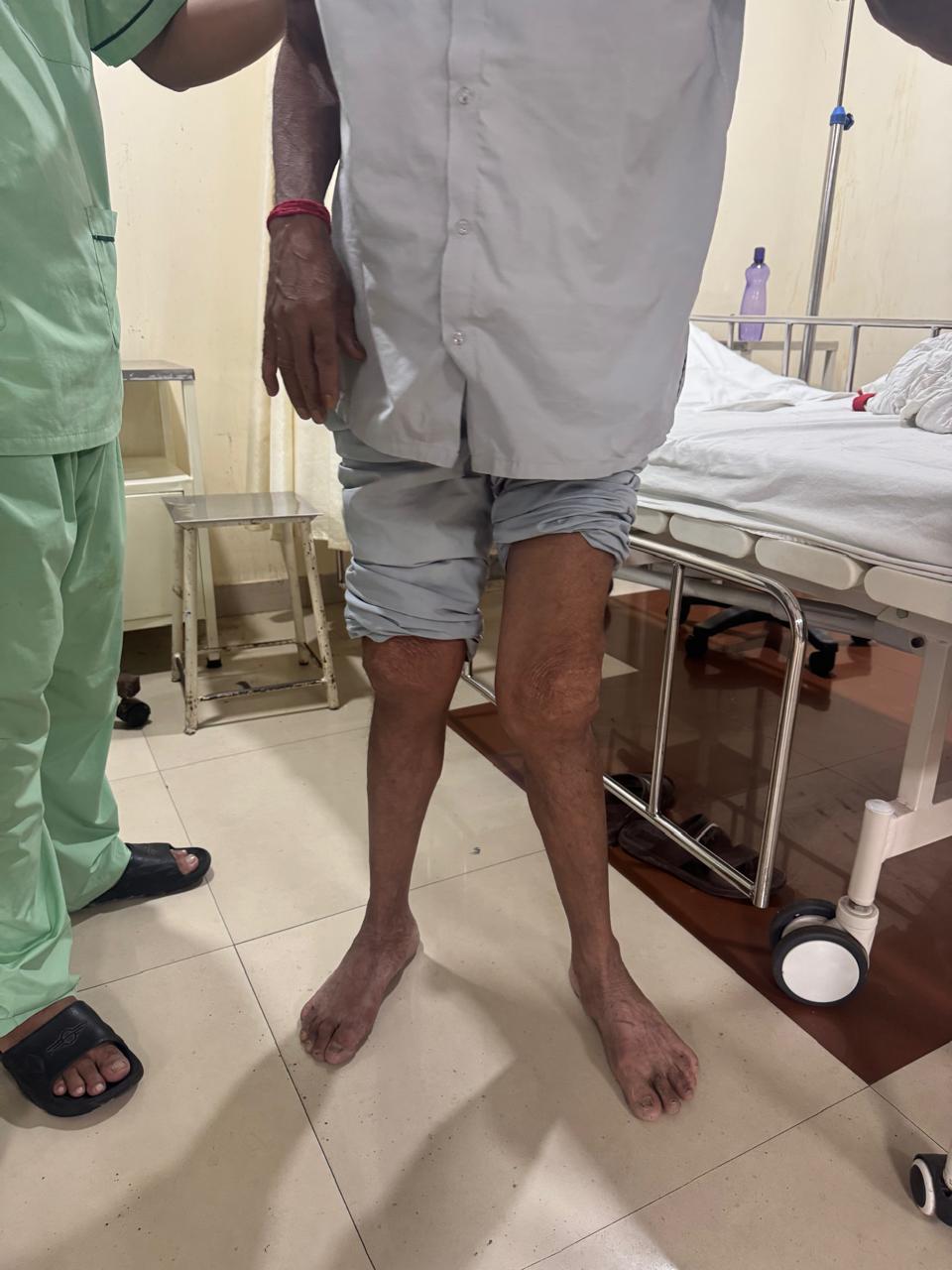 Clinical presentation of joint swelling/inflammation