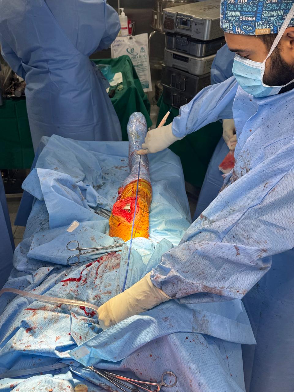 Intra-operative arthroscopic keyhole view