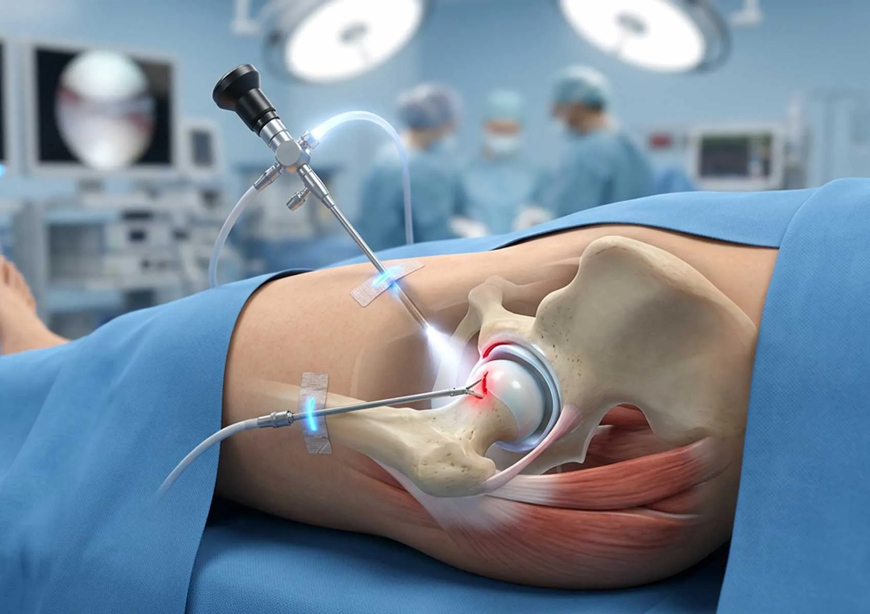 Minimally Invasive Arthroscopy